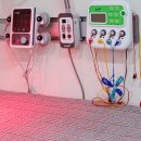 경화반점 이미지