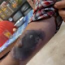 “미얀마 군부, ‘아웅산 수지 문신’ 새긴 시민 팔을 불로 지졌다” 이미지