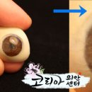 코리아의안센터 이미지