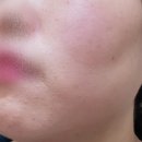 럭스메디칼 이미지