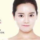 연세미의원 이미지