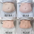 첨단기업로2L(2)-11 | [내돈내산] 신사 지방분해주사, 잘 먹고도 체중감량 성공한 제로컷 3회차 후기!