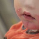 청담엔케이피부과청담NK피부과 이미지