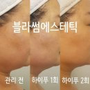 블라썸에스테틱 네이버블로그