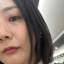 트인자리애 3차 | 청담쥬베룩 추천 ; 쥬베룩아이 시술 3차 후기