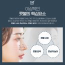 프로필성형외과의원 | 무흉영구 콧볼축소 수술 후기, 닥터미성형외과의원