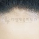 리헤어라인 - 논산시 | 리헤어라인