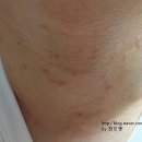 본비뇨기과의원 이미지