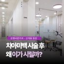 치아미백 후 이가 시린 이유, 알고 하면 덜 불안합니다