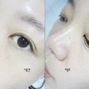 바른선 테라피