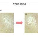 피부빛나다 - 안성시 | 피부빛나다