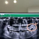 강남레옹치과의원 이미지