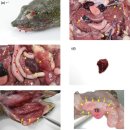 자라의 Bacillus cereus 이미지