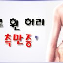 고3 수험생들의 허리가 위험하게 휘어있다? _ 척추측만증 이미지