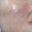 만선당약국 | 얼굴 가려움 연고 대신 피부 속건조 해결해준 순한 크림