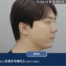 리턴옴므 이미지