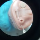 스타키보청기용산센터 이미지