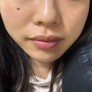 보테에스테틱 이미지