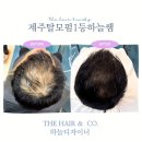 더헤어(TheHair) | 제주탈모 때문에 모자만 쓰다가, 제주탈모펌으로 달라졌어요