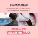 수석치과기공소 이미지