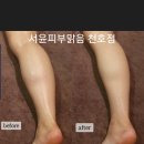 피부,맑음 이미지