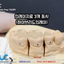 M.D치과기공소 네이버블로그