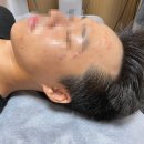 제이우뷰티 | 상도동 피부관리 제이뷰티 스킨케어 솔직후기 | 노량진 에스테틱 | 여드름성 피부 각질 관리
