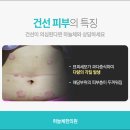 이득한의원 네이버블로그