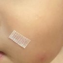 제주도아기얼굴봉합수술 제주대병원성형외과 어린이공제회서류
