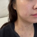 유어라인의원 네이버블로그