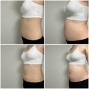 | 임신 20주 | 산부인과 정기검진, 성별확정, 임산부 비염