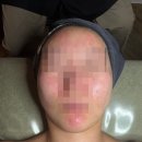 바른PC카페 | 평택 소사벌 피부바디관리 [라렌느뷰티] 여드름 관리 후기