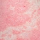 조생한의원 이미지