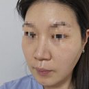 리노뷰티 | [뷰티/사용후기/내돈내산] 기초라인 1️⃣라시덤 약산성...수더앰플4️⃣스플래쉬 다이브 크림5️⃣리노베리어락크림