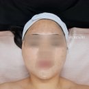 전주 피부관리 재방문 하고 싶은 곳 (윤곽관리 후기)