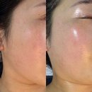 (주)아리스 | 석정동피부관리 안성 아리스민뷰티 베이직관리 추천