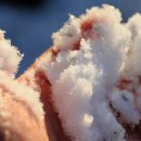 심플인플란트치과의원 이미지