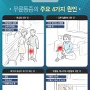 [잠실 연세이김마취통증의학과] 등산 후 무릎통증, 연골손상 신호일까? 비수술 주사치료 방법