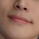 에이치봄의원 이미지