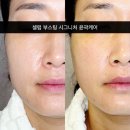 제산로 | 거제도 윤곽관리 이뻐지나 후기