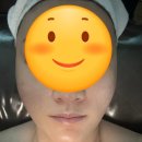 원주 로얄5케어 뷰티더아인 예신 윤곽관리 후기