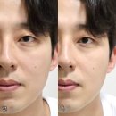 비비나인 | 좁쌀 여드름에 좋은 화장품 낫츠 재생 리페어크림 후기 여드름 흔적크림 추천