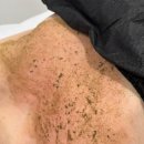부산 해운대구 라데끄랩 슈가링 부산지사 방문후기 부산가드름 관리 해운대 가드름관리 후기