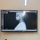 활짝핀정형외과의원 | 어깨주사 맞으러 다녀옴 _ 활짝핀정형외과