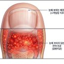 더발즈