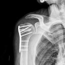 에스요양병원 이미지