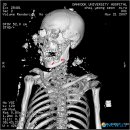 향호1리 이미지