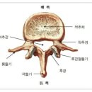 횡돌기골절 5대골절진단비보장 특별약관에 해당하는지 여부 이미지