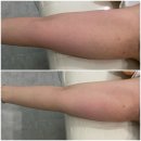 수도산 광신프로그레스 | 익산 | 다이어트 웨딩관리, 에르벨에스테틱 : 바디돔, 하이퍼젝션, 익산피부자격증