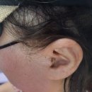 이상연보청기 이미지